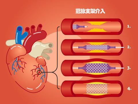 转账的钱怎么样才能撤回来_转账成功但是钱没到账_imtoken转账